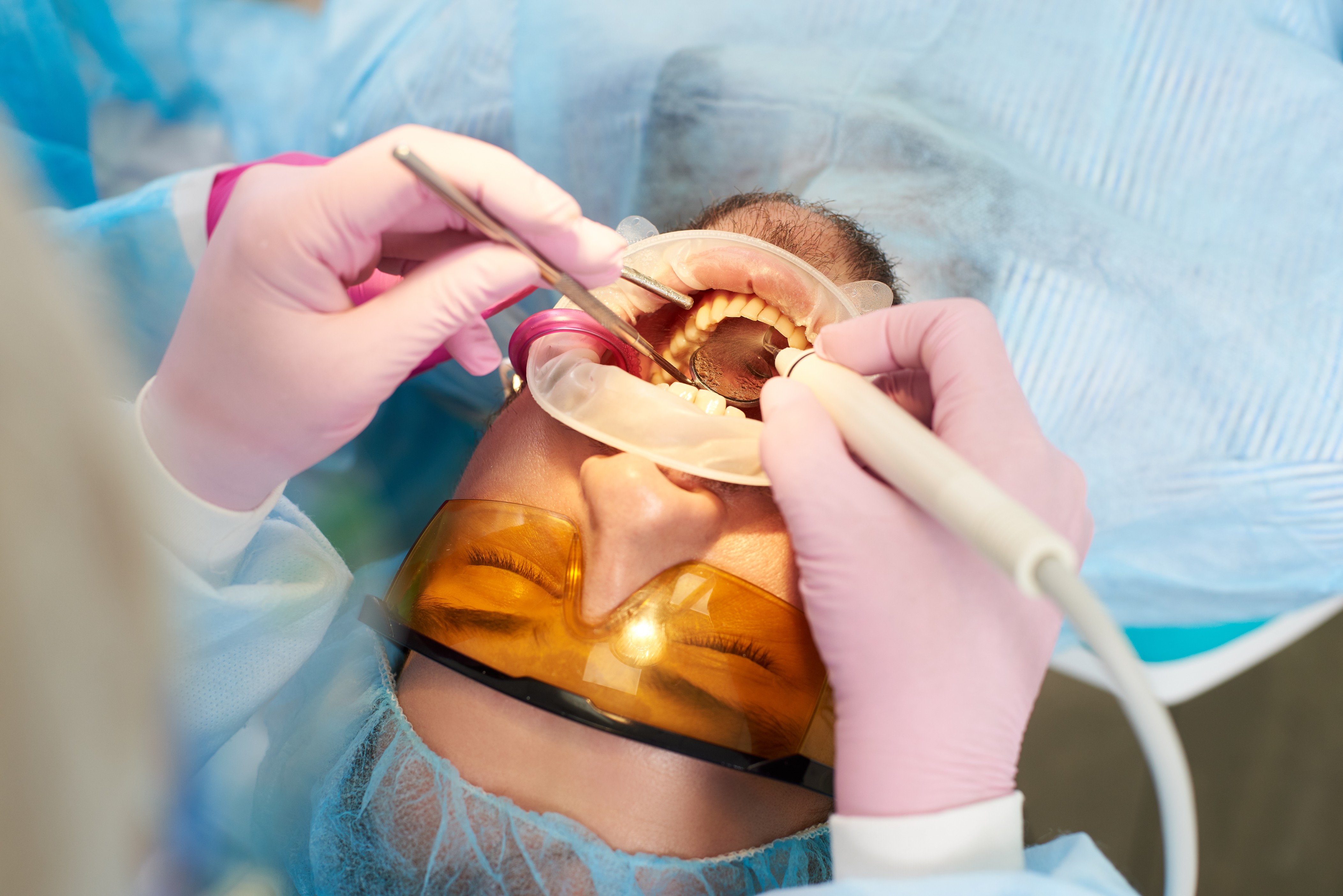 Invisible Fillings